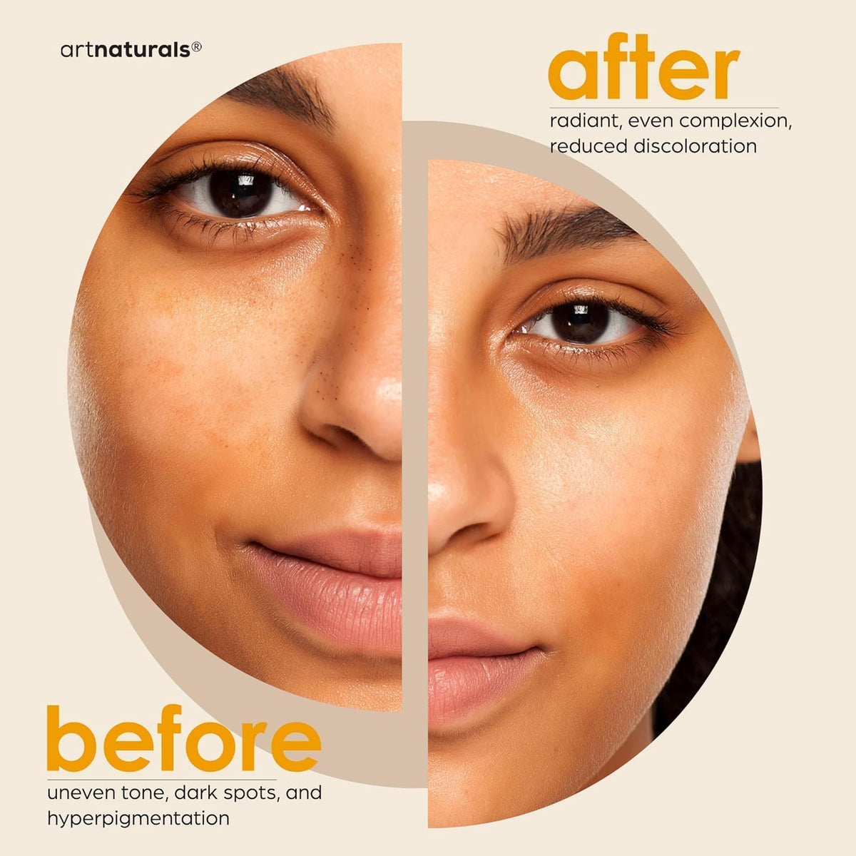 Kojic Acid & Turmeric Dark Spot Remover Soap Bars, 2 Pack - photo 4