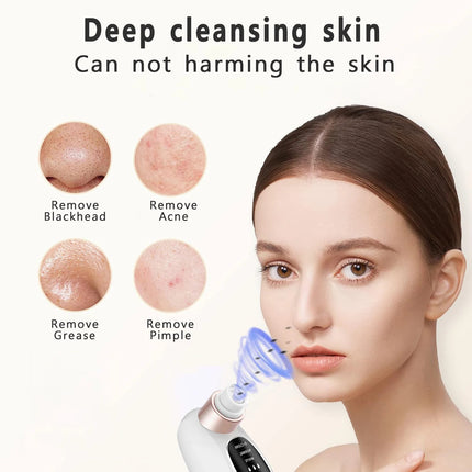 Pore Vacuum Cleaner Blackhead Remover - photo 2