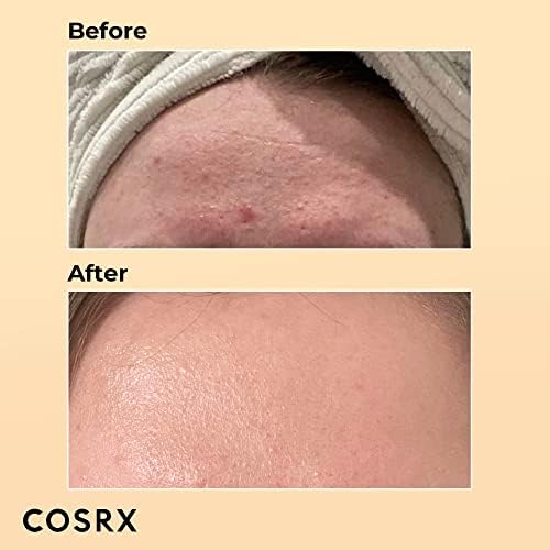 COSRX Snail Mucin texture and application on skin
