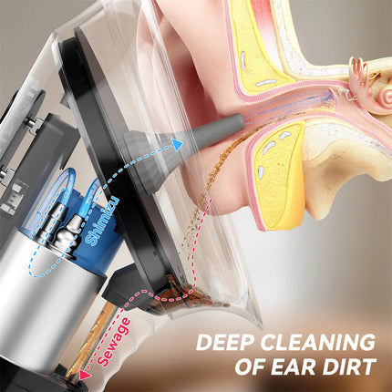 Ear Wax Water Flusher - photo 4