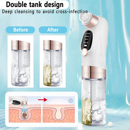 Pore Vacuum Cleaner Blackhead Remover - photo 4
