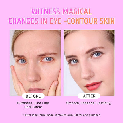 PEAUAMIE Under Eye Patches Gold and Hyaluronic Acid for puffy eyes,Rose Eye Masks for Dark Circles and Puffiness skin care Smooth Wrinkles products 30 Pairs