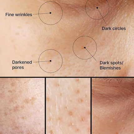 celimax Pore+Dark Spot Brightening Cream | with Niacinamide, Tranexamic Acid, TXA Cream, Pore Minimizer, Non-Irritating, Hydrating, For Sensitive Skin, 35ml, Mothers Day Gift