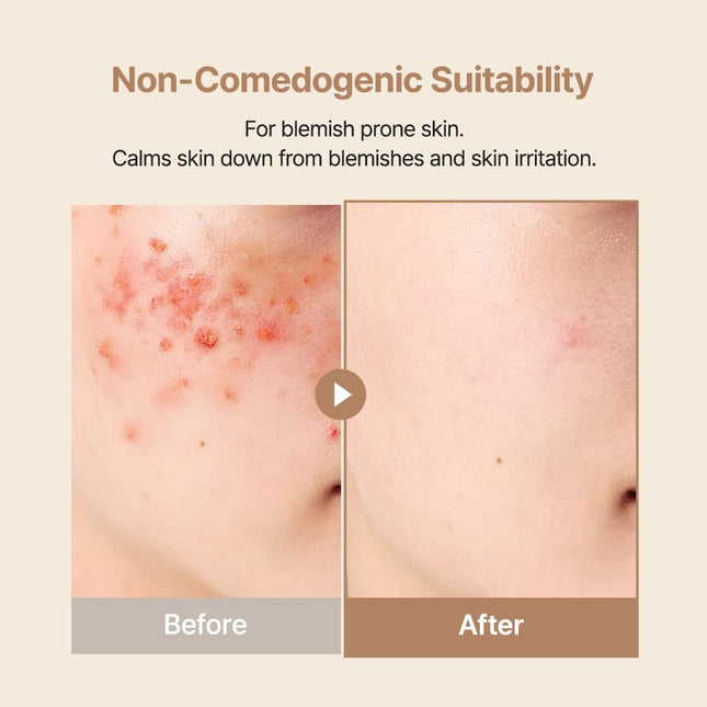 Oat In Calming Gel Cream, Non-Comedogenic, 77% Oat Seed Water