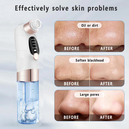 Pore Vacuum Cleaner Blackhead Remover - photo 5