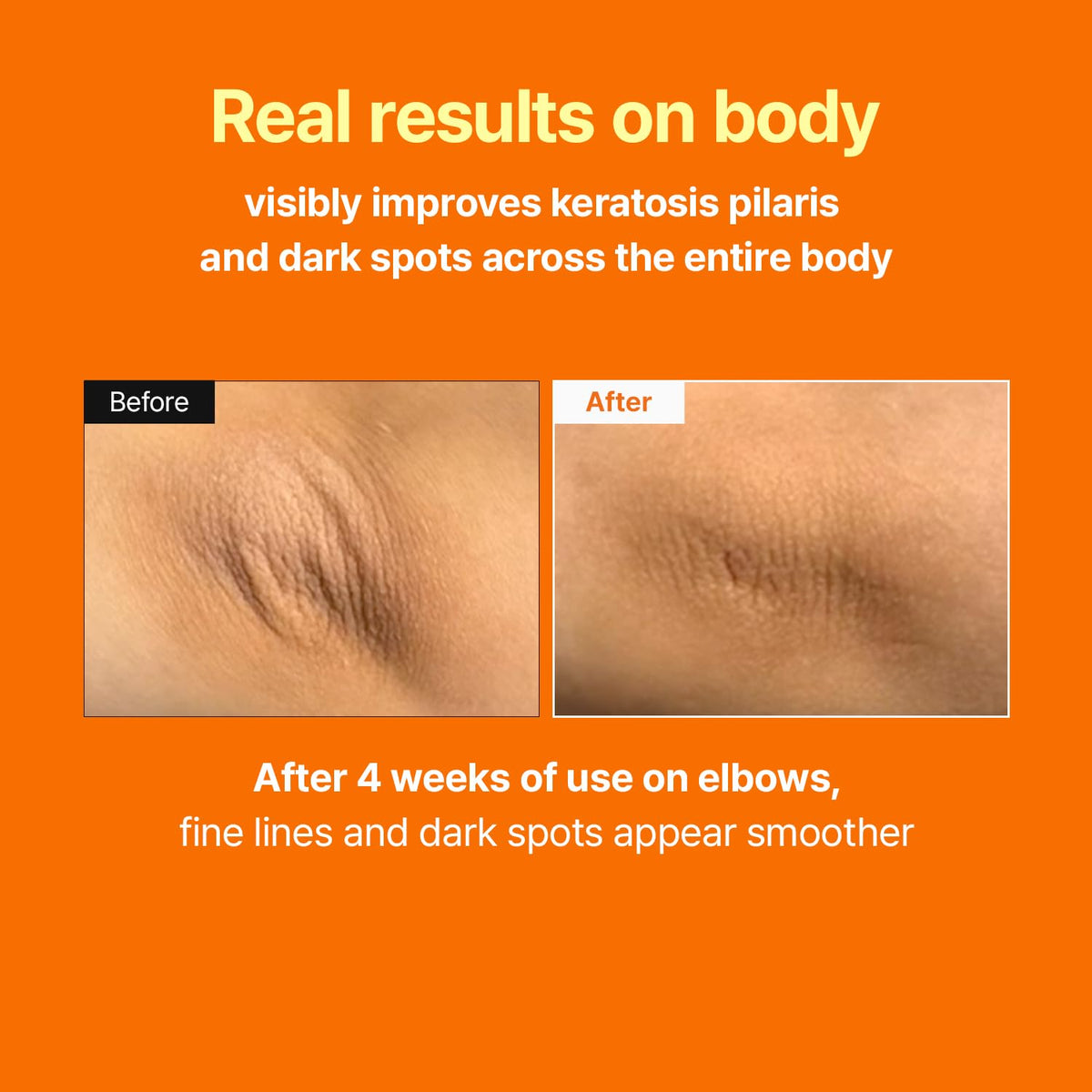 Retinal Skin Booster Serum with Retinaldehyde and Niacinamide, 5.07 fl oz - photo 4