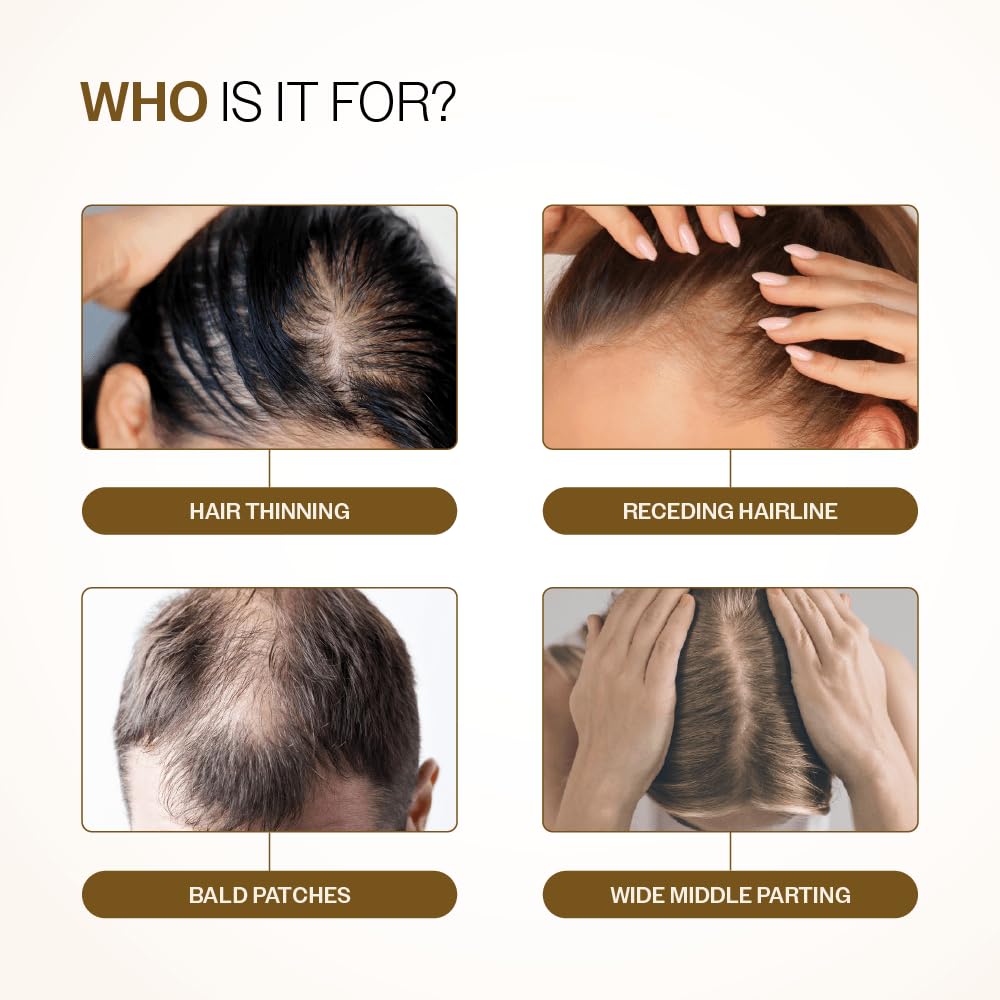 Advanced Hair Density Roll-On, 25ml - photo 3