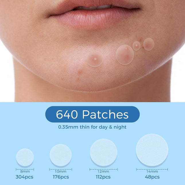 Pimple Patches for Face, 640 Count Hydrocolloid Acne Patches for Face, 4 Sizes Zit Patch for Covering, Blemishes and Breakouts, Dots Stickers with Salicylic Acid, Tea Tree Oil & Calendula Oil