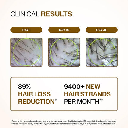Bare Anatomy Advanced Hair Density Serum boosts density with Redensyl, Anagain, Baicapil & Capilia Longa. Rosemary & rice water reduce hair fall for men & women.