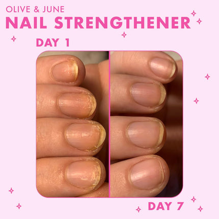 Nail Strengthener, Treatment for Weak and Brittle Nails