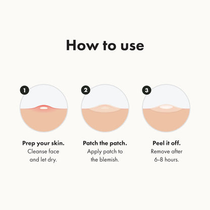 Hydrocolloid Acne Pimple Patches, 72 Count - photo 4