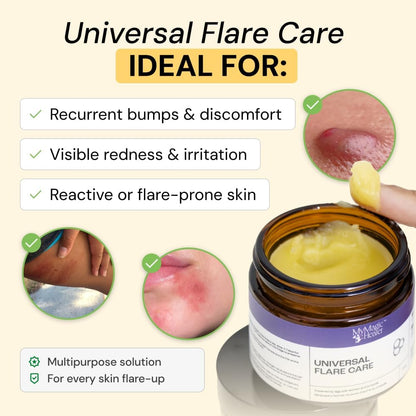 Universal Drawing Salve for Everyday Skin Flare-Ups, 4 oz - photo 2