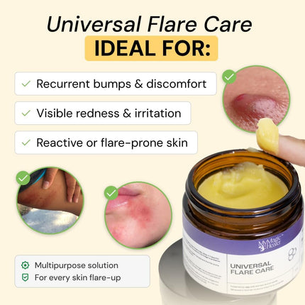 MyMagicHealer Universal Flare Care – Multi-Purpose Solution | Skin Flare-Ups - Hidradenitis Suppurativa, Folliculitis, Boils, Cysts | Anti-Chafing | Irritated Skin Relief w/Propolis & Egg Yolk 1 oz
