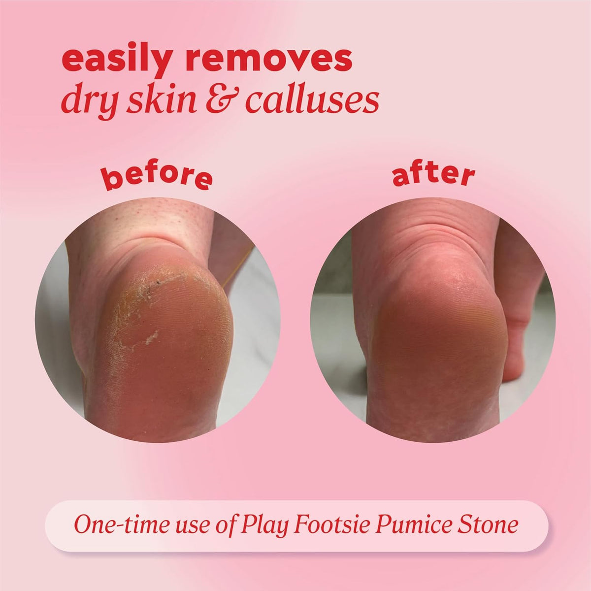 Double Sided Siliglass Pumice Stone Callus Remover, 2 Pack - photo 3