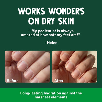 Vermont's Original Skin Moisturizer - Cuidado hidratante para todo el cuerpo: manos, labios, rostro, pies y más - Sin fragancia, libre de crueldad y parabenos - Día y noche, hombres y mujeres (lata de 4oz, Made in USA)