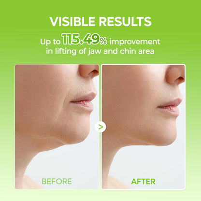 V-Lifting Mewing Band for Jawline, Chin & Facial Puffiness - photo 5