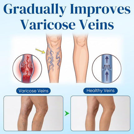 Vein Target Microdarts Patch, Professional Varicose Veins for Legs Patch, Natural Ingredients Leg Treatment for All Skin Types (2 Pack)