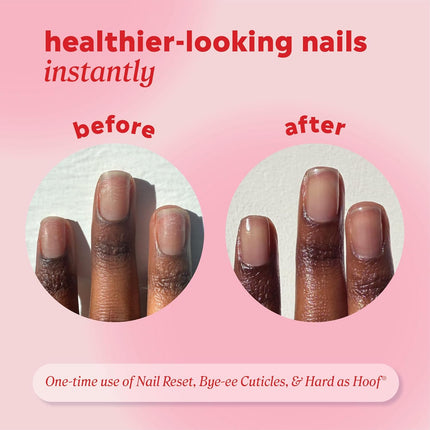 Onyx Professional Hard as Hoof Nail Strengthening Cream, Island Coconut Scent - Nail Growth and Conditioning Cuticle Cream Stops Splits, Chips, Cracks & Strengthens Nails, 1 oz
