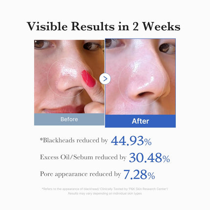 medicube Zero Pore Toner Pads 2.0 - before after