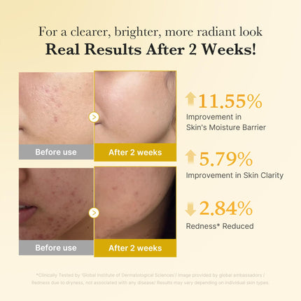 Kojic Acid Turmeric Clarifying Capsule Serum for Troubled Skin
