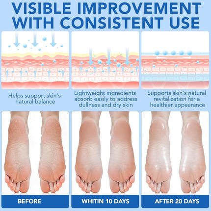 Urea Cream, Maximum Strength Urea Foot Cream, 60% Urea Cream Stick plus 2% Salicylic Acid Callus Remover for Dry Cracked Heels, Hands, Knees, Exfoliating Moisturizer, Dead Skin Remover Foot Balm 1.4OZ