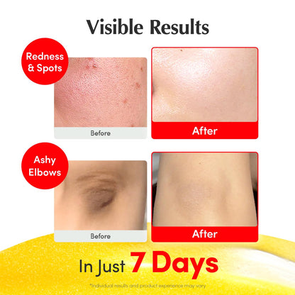 Vitamin Illuminating Face Serum with Niacinamide 4%, TXA & Hyaluronic Acid, 1.01 fl oz - photo 4