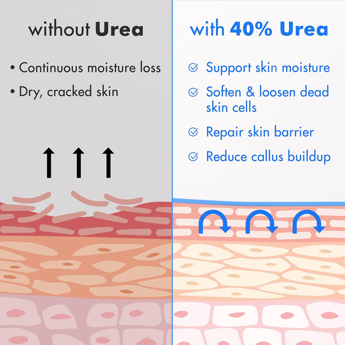 Urea Cream 40% plus Salicylic Acid 2%, Foot Cream for Dry Cracked Heels Feet Knees Elbows Hands, Foot - photo 5