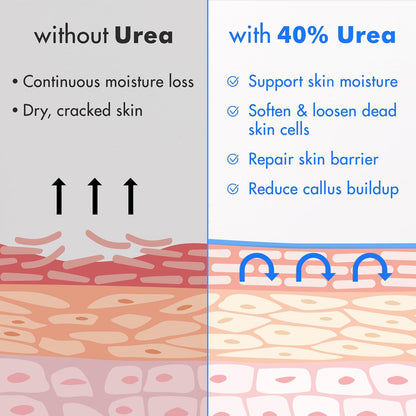 Urea Cream 40% plus Salicylic Acid 2%, Foot Cream for Dry Cracked Heels Feet Knees Elbows Hands, Foot - photo 5