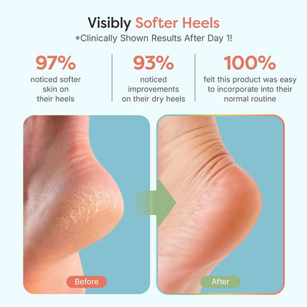 Moisturizing Socks for Cracked Heel Treatment, Vitamin E, Olive Oil and Jojoba Oil Infused Heel Socks, Spa Gifts for Women, Mothers Day Gifts (Fuzzy Blue, Regular)