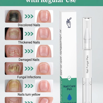 BEAUTIFUL HYDRATION Nail Fungus Pen, 2026 New Toenail Fungus Pen with 25% Undecylenic Acid and Tea Tree Oil, Extra Strength Nail Repair for Damaged Nails, Fungal Nail Treatment for Nail Care