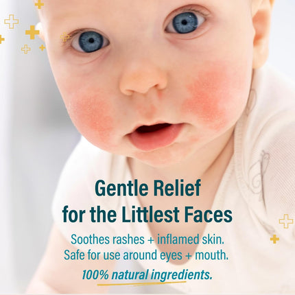 A+D Gentle Face Relief Cleanser for Little Ones with Hypochlorous Acid 3 oz - 100% Natural Ingredients, Non-Toxic, Sting-Free Formula, Safe Around Eyes & Mouth