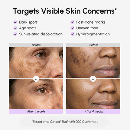 MAREE Dark Spot Remover for Face and Body – Dark Spot Corrector Serum – Hyperpigmentation, Melasma, Sun & Age Spots – Black & Brown Spot Remover for Women – Crema para Manchas Oscuras en la Cara