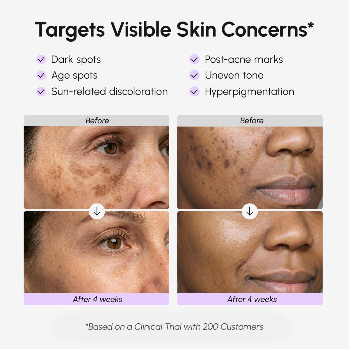Dark Spot Corrector Serum for Face and Body - photo 3