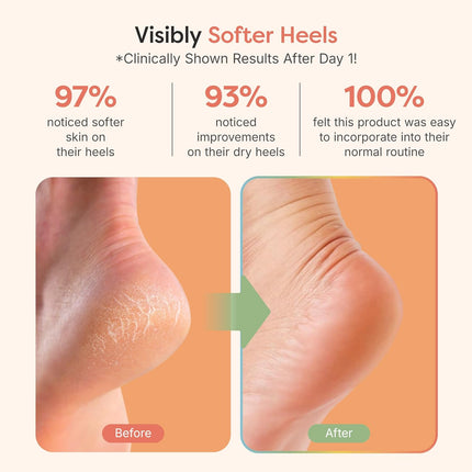 ZenToes Moisturizing Socks for Cracked Heel Treatment, Vitamin E, Olive Oil and Jojoba Oil Infused Heel Socks, Spa Gifts for Women, Mothers Day Gifts (Fuzzy Pink, Regular)