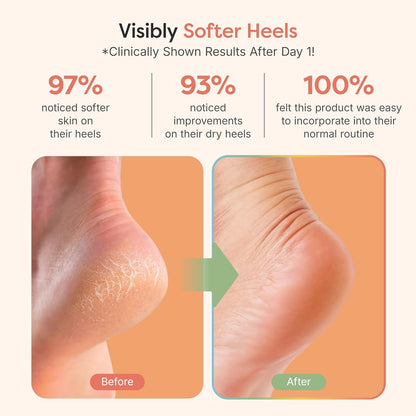 Moisturizing Heel Socks for Cracked Heel Treatment, Fuzzy Pink Regular - photo 3