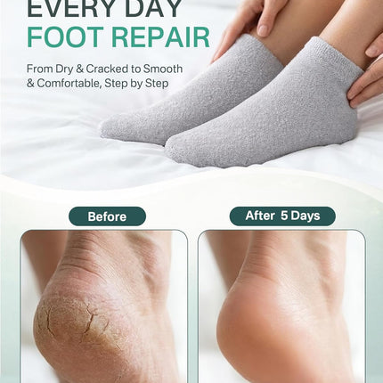 Moisturizing Socks for Dry Cracked Feet, Silicone Socks for Foot Spa(Size 9-11), Gel Socks for Foot Care Overnight, Aloe Socks Heel Protector for Cracked Heel Treatment, Self Care Gifts for Women