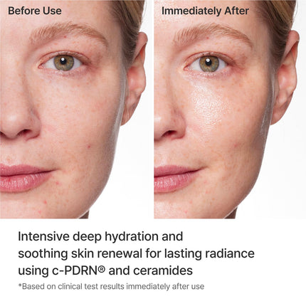 Turnover Mask, c-PDRN® Face Mask, 5ea x 1.35 fl oz