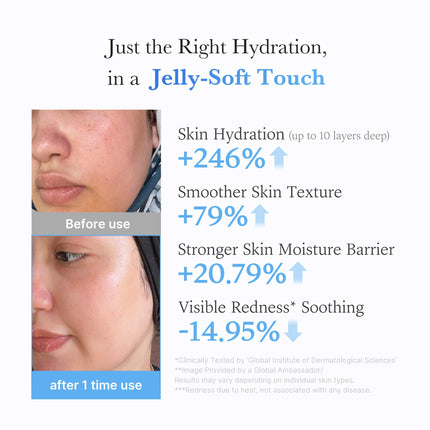 Jelly Cream with Hyaluronic Acid for Long-lasting Hydration