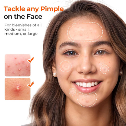 443 Count Pimple Patches for Face, Hydrocolloid Acne Patch Bulk - photo 3