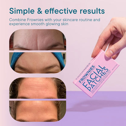 Forehead and Between-the-Eyes Wrinkle Patches, 144 Count - photo 4