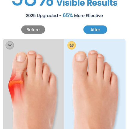 Bunion Corrector, Toe Separators for Women Men Big Toe, Toe Spacers, Bunion Correction, Breathable