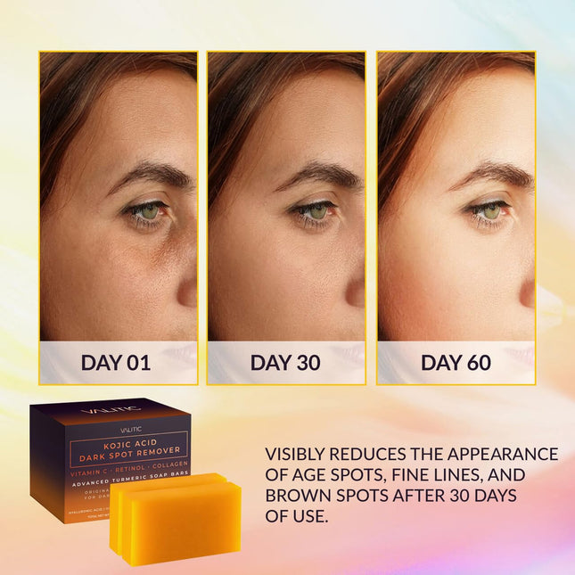 Kojic Acid Dark Spot Remover Soap Bars with Vitamin C, Retinol, Collagen, Turmeric - Original Japanese - photo 2