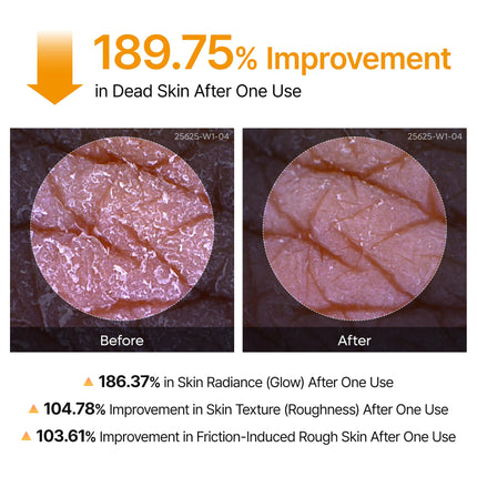 Peel Shot Kojic Acid Turmeric Body Exfoliator Spray 6.76 fl.oz - AHA PHA Niacinamide Body Scrub for KP Bumps, Dark Spots, Uneven Skin Tone, Dead Skin, Korean Skin Care