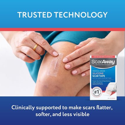 ScarAway Clear Silicone Scar Tape, Medical-Grade Cut-to-Size Silicone Strip for Surgery, Burn, Hypertrophic & Keloid Scars, Self-Adhesive, Water-Resistant, 1 Roll